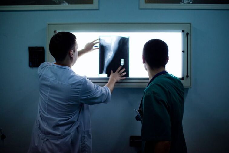 X -Ray жөнүндө антроз диагностикасы