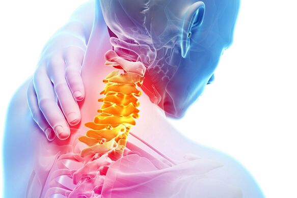 Жатын моюнчасынын остеохондрозу